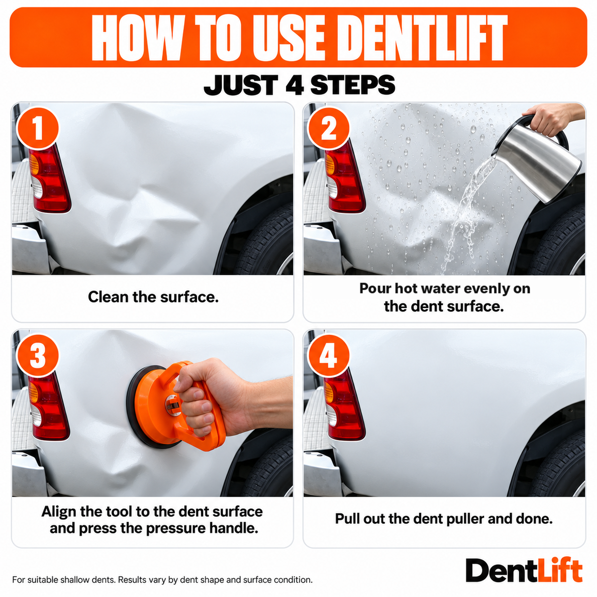DentLift™ - Suction Dent Puller